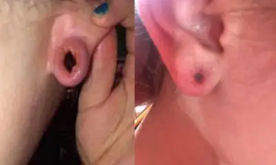 Boyfriend Slept With Her Through The Ear