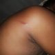 Man who dreamt of being slashed with a knife calls for prayers as he wakes to find a cut on the same spot - YabaLeftOnline