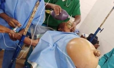Lady undergoes successful Surgery for the removal of Ovarian Tumor in Imo State  - Contents101