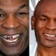 celebrities-with-missing-teeth
