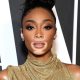 Winnie Harlow (Model) Wiki, Biography, Age, Boyfriend, Family, Facts and More