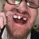 Man spent 80k fixing his dentition after cocaine abuse and horror operations left his teeth falling out